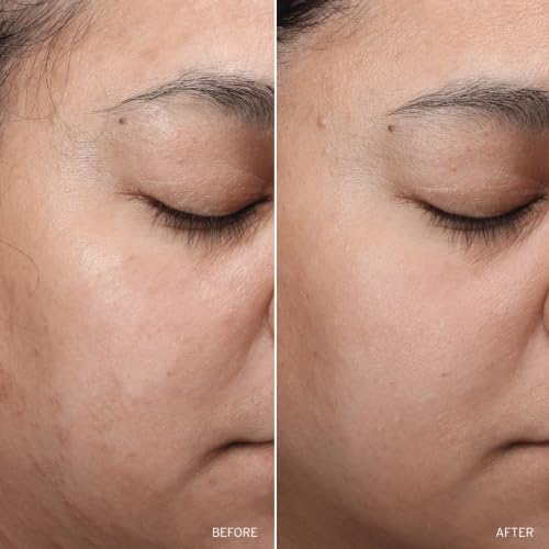 Aramore | NAD+ Renew & Restore Bundle | Retinol Peptide Boosting Serum + NAD+ Cell Restoration Cream | Overnight Skincare Set for Smoother, Firmer & More Radiant Looking Skin - Image 7