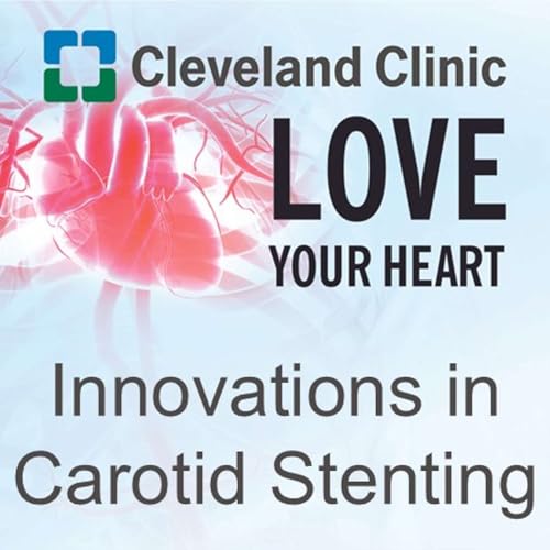 Innovations in Carotid Stenting cover art