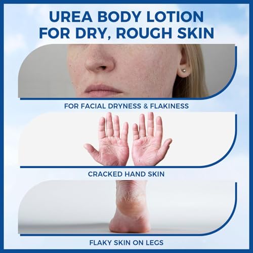 Image of OUKEYA Urea Cream for Dry Chapped Skin with 10% Urea Deep Moisturizer Body Lotion, Softens & Soothes Hands Elbows Feet Hydrates Locks in Moisture, Fast Absorbing & Non-Greasy, 11.28 oz Large Capacity