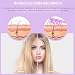 Imagen de Alta Frecuencia Facial