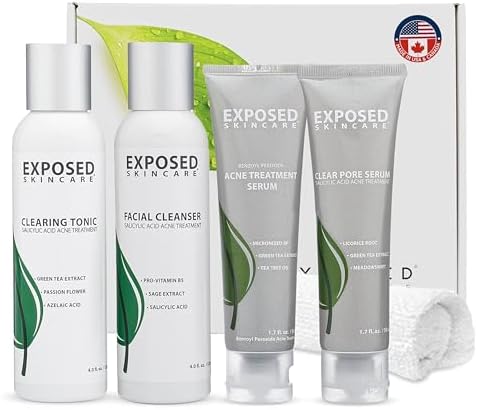 Exposed Skin Care 5-Piece Basic Acne Treatment Kit
