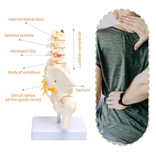 Image of Lumbar Column Spinal Model 8.6 inch Sacrum and Spinal Nerves Anatomy Skeleton Model with Pelvis for Medical Student Learning, Research, Teaching Demonstration | Anatomy Skeleton Model, With Pelvis, For Medical Student Learning, Research, Teaching Demonstration