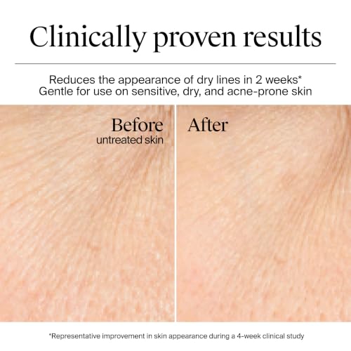 Neutrogena Hydro Boost Hydrating Gel Cream Face Moisturizer for Sensitive Skin 1.7 fl oz plus Hydrating Gel Cleanser 0.5 fl oz Alcohol and Fragrance Free Hyaluronic Acid Daily Hydration Routine - Image 6