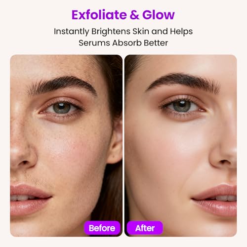 Image of Dermaplane Razor for Women Face with 10 Replacement Blades, 3 Adjustable Speeds, Gentle & Painless Peach Fuzz Remover for Smooth Skin,Built-in LED Light Dermaplane Razor Eyebrow Trimmer