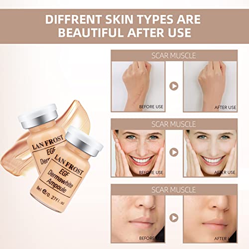 bb-serm-Pigment-Serum-Starter-Kit-12-Vials-Hyaluronic-Acid-Moisturizing-Skin-Care-bb-serm-027-Fl-Oz-Light-Rose