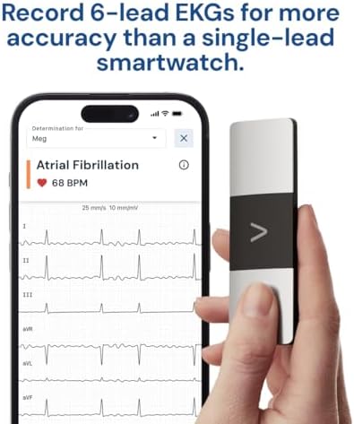 KardiaMobile 6-Lead Personal EKG Monitor