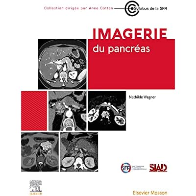 Imagerie du pancr&eacute;as