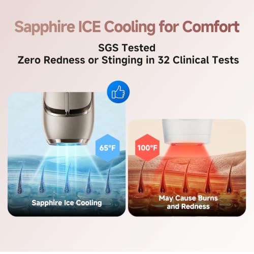 Image of Dreame Nova IPL Hair Removal with Dual-Lamp 27J Output, Sapphire ICE Cooling, 3.9cm Window, 0.2s Flash, Adaptizone AI Detection, Photon Skincare, Up to 96% Reduction Full-Body for Women and Men