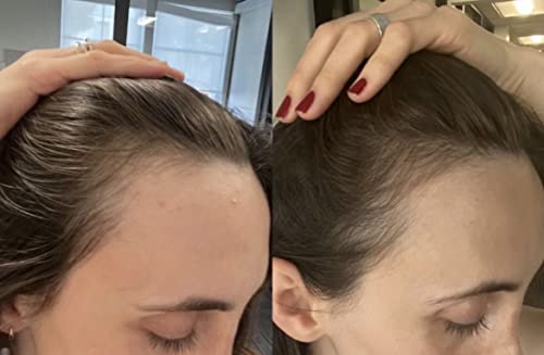 Growing-Season-Hair-Growth-And-Repair-Oil-With-Burdock-Nettle-Oil-and-Vitamin-C-for-Visibly-Fuller-Stronger-and-Shinier-Hair