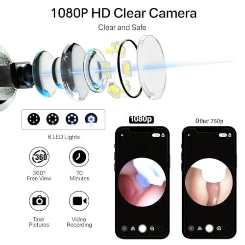 Image of Ear Wax Removal Tool Kit - HD Camera WiFi Endoscope with 6 LED Lights, Otoscope Ear Cleaner for iOS Android, 8-Piece Set for Kids Adults