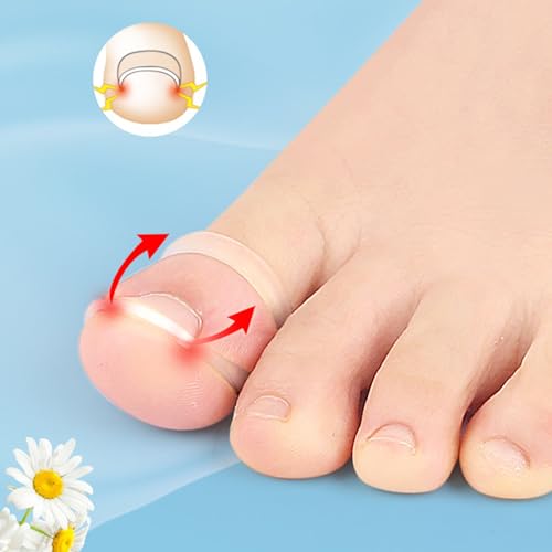 Corretor de unhas dos pés, 10 peças, ferramenta de correção de unhas encravadas de silicone reutiliz