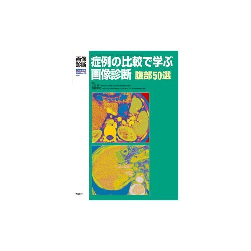 スマホ 無料電子書籍 症例の比較で学ぶ画像診断腹部50選 28ー4 (画像診断 08年臨時増刊号) バイ