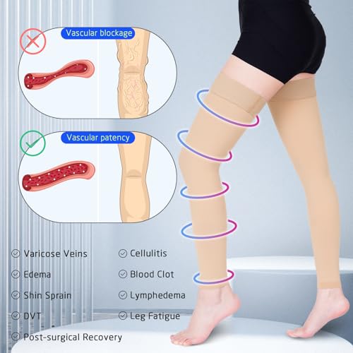Image of 15-20 mmHg Compression Stockings for Women & Men, Thigh High Compression Socks Medical Graduated Compression Support for Edema, Varicose Veins