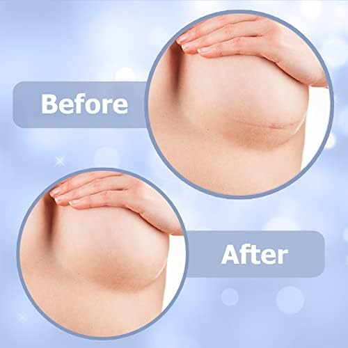 Areola Silicone Sheets - Breast Surgery Recovery Supplies - Reusable and Comfortable Under Post-Op Bra (2 Pcs)