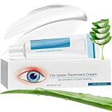 Blepharitis Treatment Eye Cream, Chalazion Eye Treatment, Relief Eyelids Cream for Soothe Stye, Dry Eyes & Swollen Eyelids, Hydrating Formula for Comfort & Healthy Gentle Daily Eyes Care