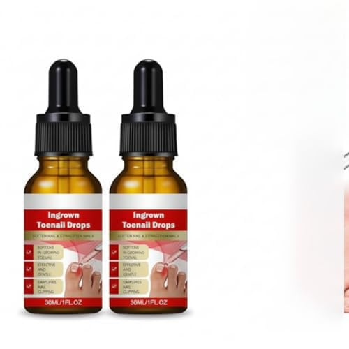 NALACAL 2PCS Ingrown Toenail Relief Kit – Toenail Softener Drops with Silicone Gel Toe Caps, Easy Trim Tools, and Essential Oil Formula for Soothing Ingrown Nails