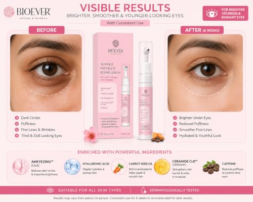 Image of Under Eye Serum with ameyezing, Ceramide CLR /Caffeine /Hyaluronic Acid /Carrot Seed Oil | For Reduce Dark Circles, Puffiness, reduce Wrinkles, Crows Feet, hydrates your skin -10ML