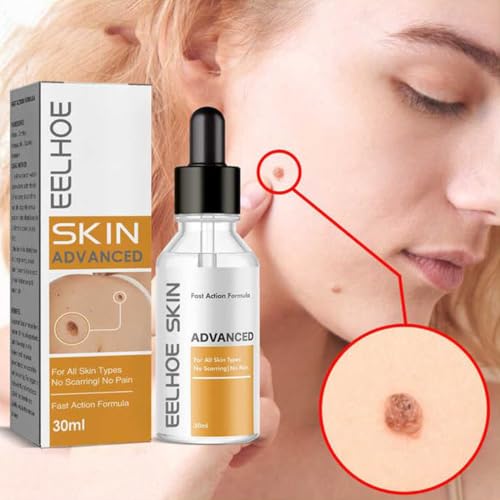 Image of Skin Tag & Mole Remover Serum - Quick-Acting Natural Formula for Face and Body - Simple to Use, 30ML