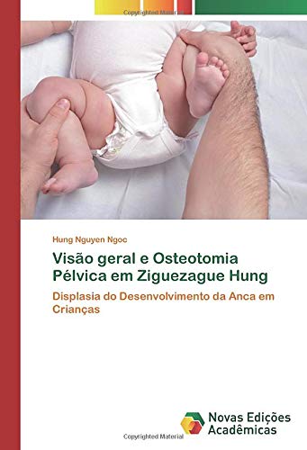 Vis�o geral e Osteotomia P�lvica em Ziguezague Hung: Displasia do Desenvolvimento da Anca em Crian�as