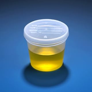 Globe Scientific 5917 Specimen Container with Separate Snap Cap, PP, Graduated, 5oz, 70mm Diameter, 67.7mm Height, Pack of 300