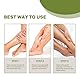 Krampfadern Creme Varicose Veins Cream, Natürliche Inhaltsstoffe Varicose Veins Treatment Beine Care Salbe, Verbesserung der Blutzirkulation Krampfadern und Besenreiser Entfernen