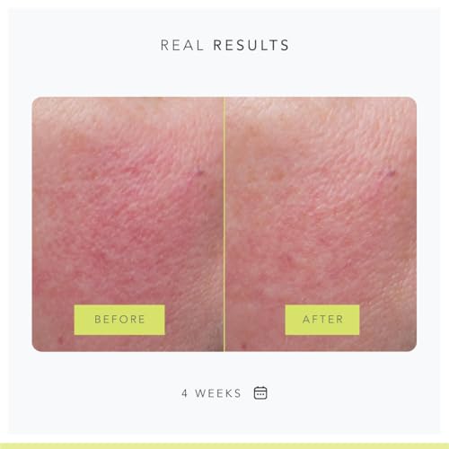 Glow Up: Unlock Youthful Skin with Juice Beauty