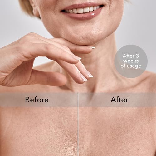 Intimia Travesseiro de peito para rugas no peito e sono lateral - Almofada de peito para prevenção d