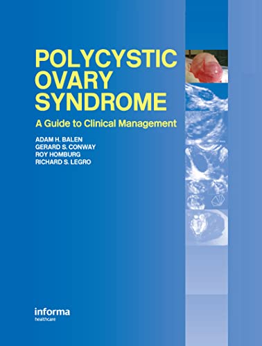 Polycystic Ovary Syndrome: A Guide to Clinical Management (English Edition) - Balen, Adam H.