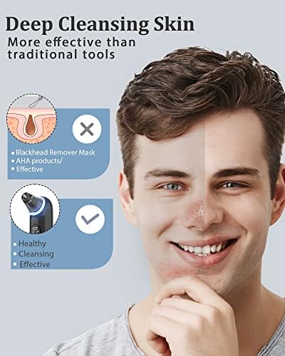 Blackhead Remover Vacuum Pore Vacuum, Electric Blackhead Remover for Face Acne Whitehead with 3 Suction Power, 4 Probes and LED Display, Deep Cleansing Unclogging Pores Blackhead Remover Tool