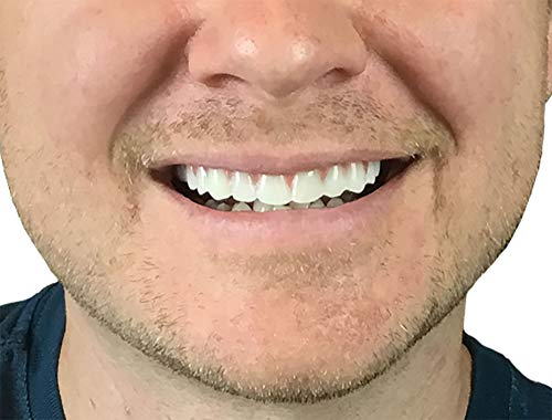 Instant Smile 34054 2 Pack - Instant Smile Natural Shade Comfort Fit Flex Veneers thumb #3