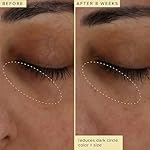 Farmacy Brightening Eye Cream - Wake Up Honey Under Eye Cream for Dark Circles + Puffiness - Enriched with Vitamin C + Cranberry Peptide to Smooth Wrinkles Over Time (15ml) - Image 4