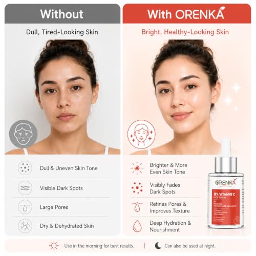 Image of 10% Vitamin C Face Serum with Niacinamide, Tranexamic Acid & Alpha-Arbutin for Brightening, Pigmentation & Even Skin Tone | Lightweight Daily Serum for All Skin Types - 30ml