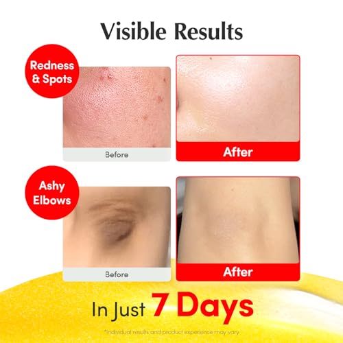 EQQUALBERRY Vitamin Illuminating Serum – Brightening Vitamin C Serum with Niacinamide | Strengthens skin barrier | Hydrates using Ceramide and Hyaluronic Acid, 1.01oz / 30ml