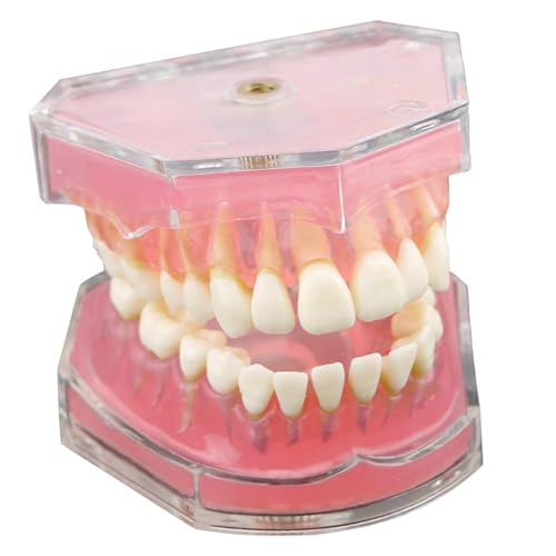 Modèle de dents Typodont amovibles enseignement dentaire et simulation de soins