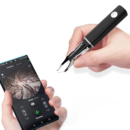 Scopepickeu Pinzas de depilación visual con cámara de 1080p, luz LED, pinzas de precisión recargables por USB WiFi, para cabello blanco, vello de las orejas, cejas, pestañas (negro)