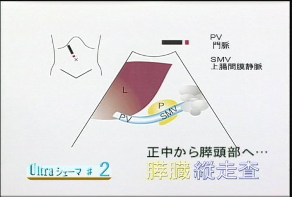 【美品DVD】チャレンジ！超音波走査 上巻 技術習得教材 Amazon.co.jp: チャレンジ! 超音波走査（上巻）ケアネットDVD