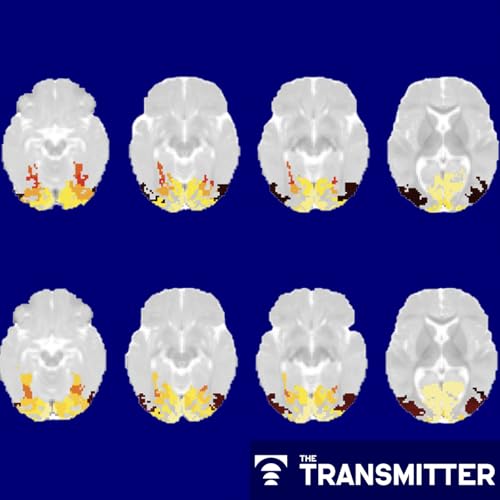 Infant visual system categorizes common objects by 2 months of age