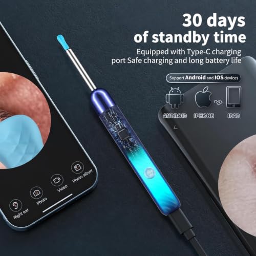 Image of Yorsfun Ear Wax Removal Kit with Camera, Otoscope with 7 Ear Spoon | 1080P HD ear cleaner, 6 LED lights, 7 ear spoons, 6 ear tips, works with iOS and Android