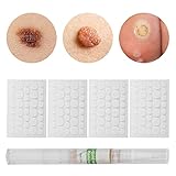 【Cómodo de usar】 El dolor y las cicatrices desaparecerán lentamente, son adecuados para todo tipo de piel y se pueden usar en la cara y el cuerpo.Adecuado para diferentes partes del cuerpo, se pueden usar de manera segura en los dedos, brazos o pies, axilas, cuello. piel, etc.