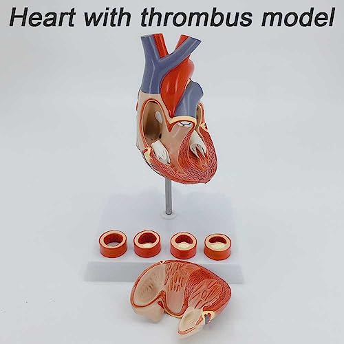 Modèle de cœur 3D AMITD à 2 pièces détachables pour simuler les thrombus - 3
