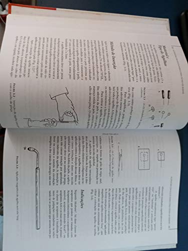Técnicas Simples Que Complementam A Acupuntura E A Moxabustão