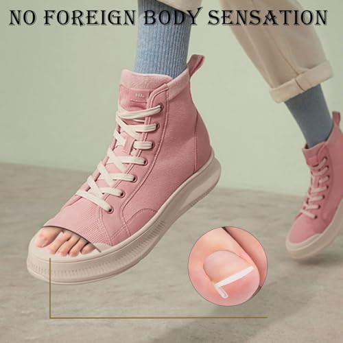 Image of 102pcs Ingrown Toe Nail Remover, Toenail Corrector Strips and Ingrown Toenail Correction Tool, for Daily Nail Care and Post-Exercise Maintenance,