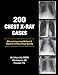 200 Chest X-Ray Cases