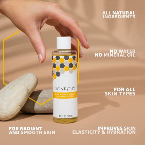 Sonroby Natural Body Oil Scar & Stretch Mark Serum With Almond Oil & Vitamin E Oil For Scars, Ideal For Pregnant And Nursing Women. Great For Kids And Babies, 4.2 Fl Oz #TOP1