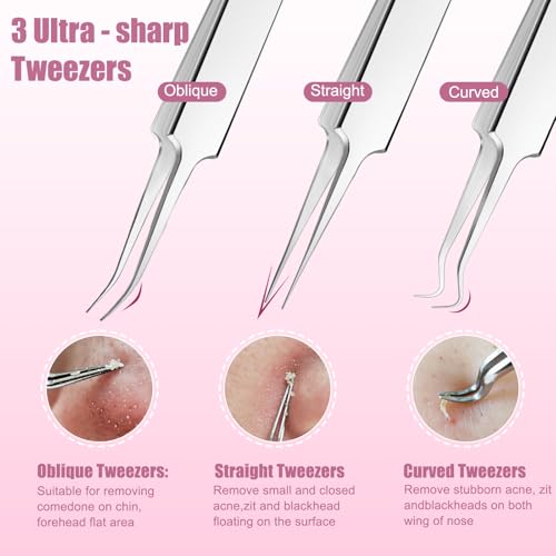 MORGLES Kit de Ferramentas para Remover Espinhas com 15 Peças, Removedor de Cravos de Aço Inoxidável
