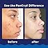 PanOxyl 10% Acne Foaming Wash 5.5 Ounce (Value Pack of 2)