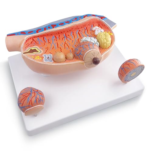Image of EVOTECH SCIENTIFIC Human Ovary Anatomical Model, 13 Parts Female Ovarian Structure Anatomy and Follicular Development Model for Medical Teaching Learning Research Education Display