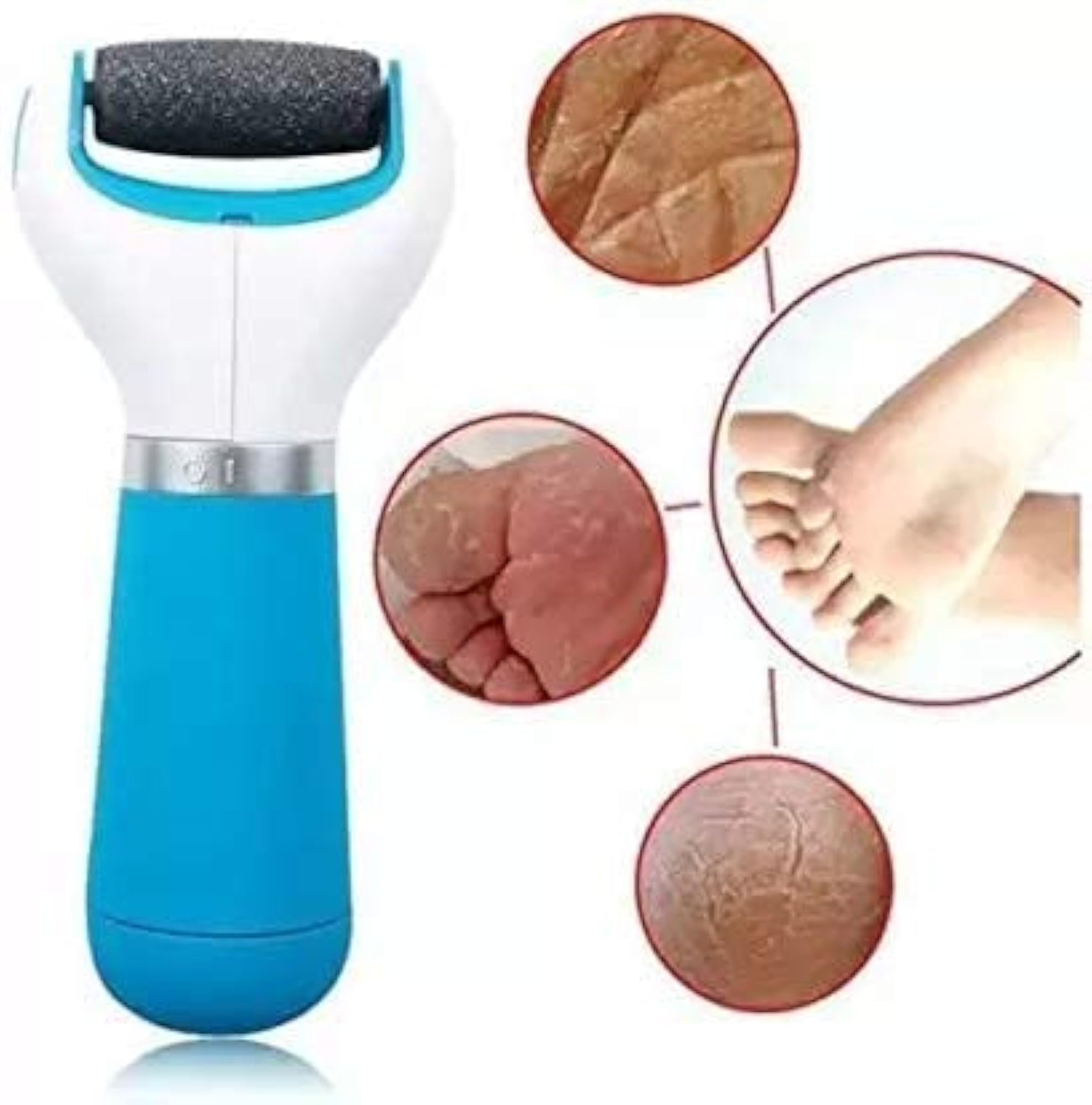 Battery Operated Electric Foot Scrubber for Dead Skin Removal