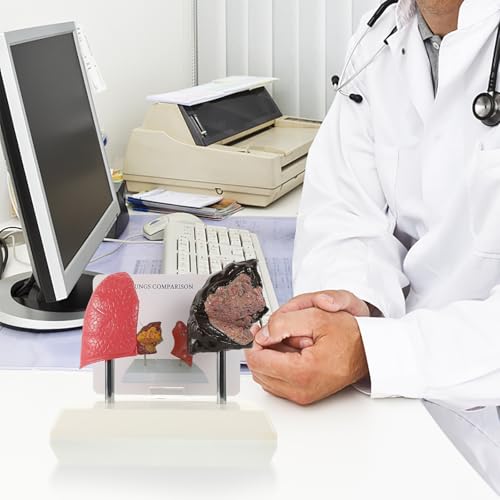 Modèle pulmonaire pour expliquer les dangers du tabagisme - 3
