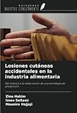  Lesiones cutáneas accidentales en la industria alimentaria: Del análisis a la elaboración de una estrategia de prevención